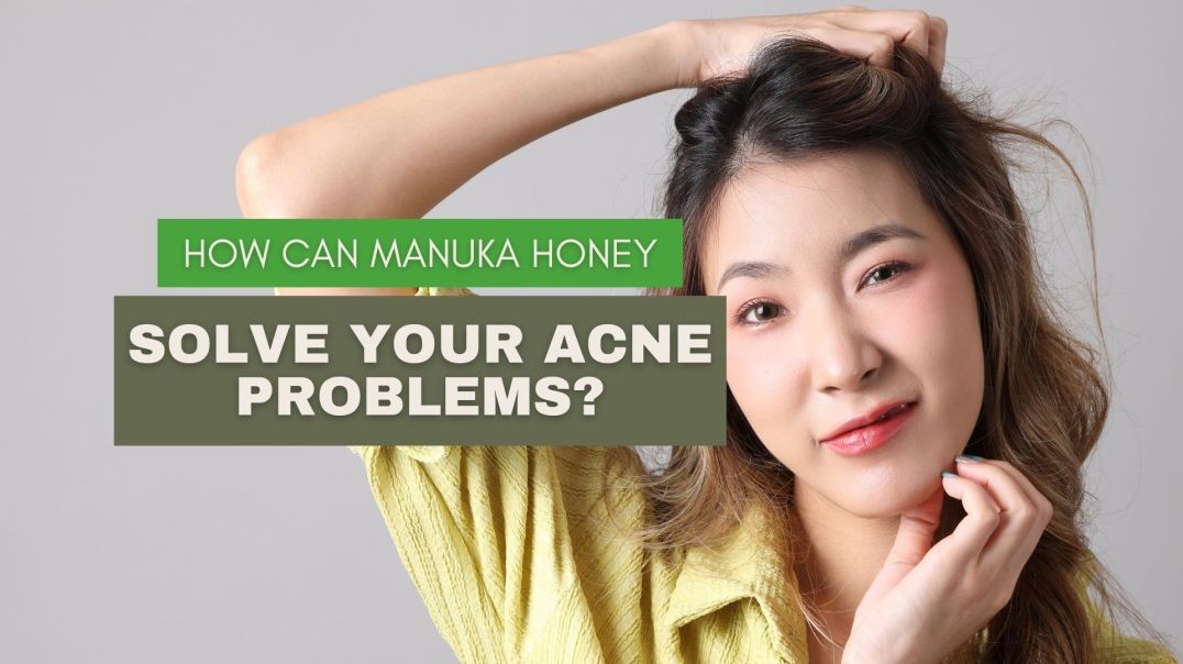 How Can Manuka Honey Solve Your Acne Problems