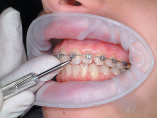 Emergency Dental Clinics Network Across Canada & USA
