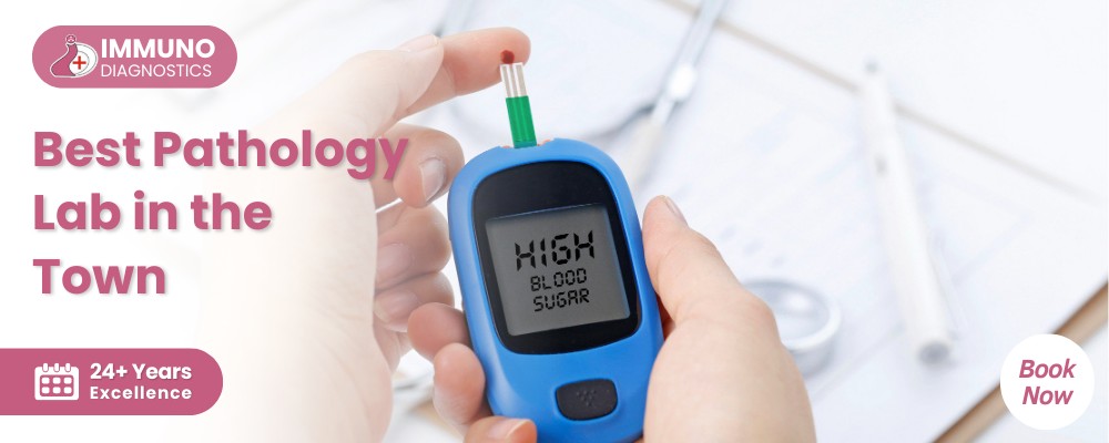 Pathology Lab In Janakpuri Delhi - Immuno Diagnostics