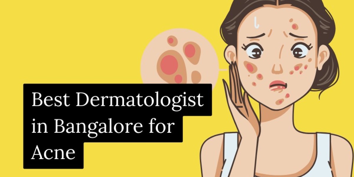 Best Dermatologist in Bangalore for Acne