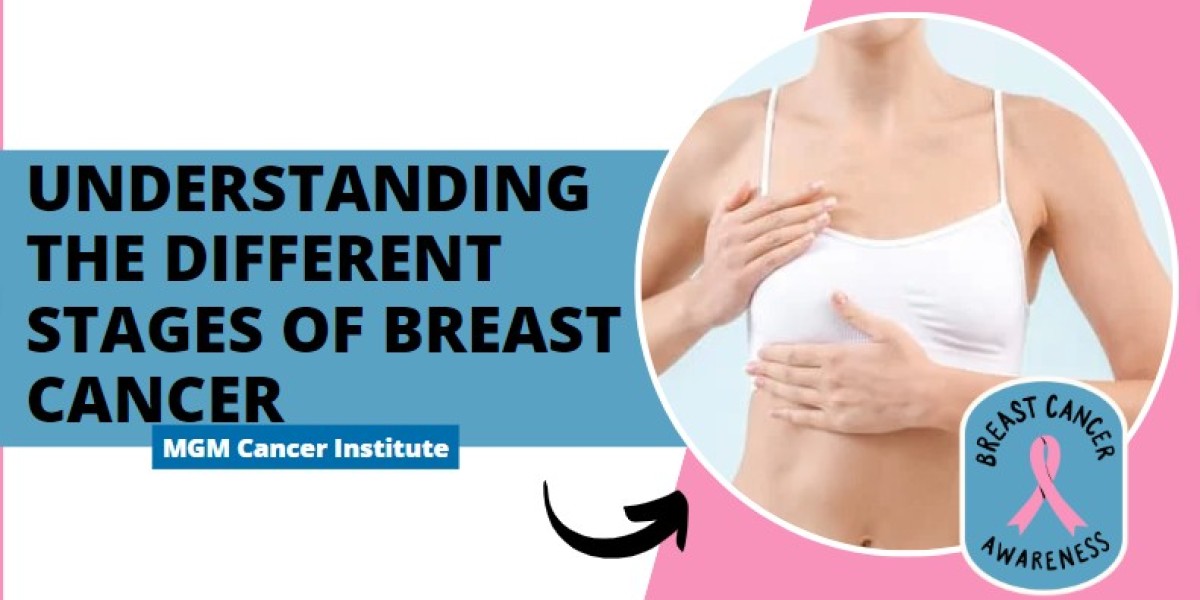 Understanding the Different Stages of Breast Cancer | MGM Cancer Institute