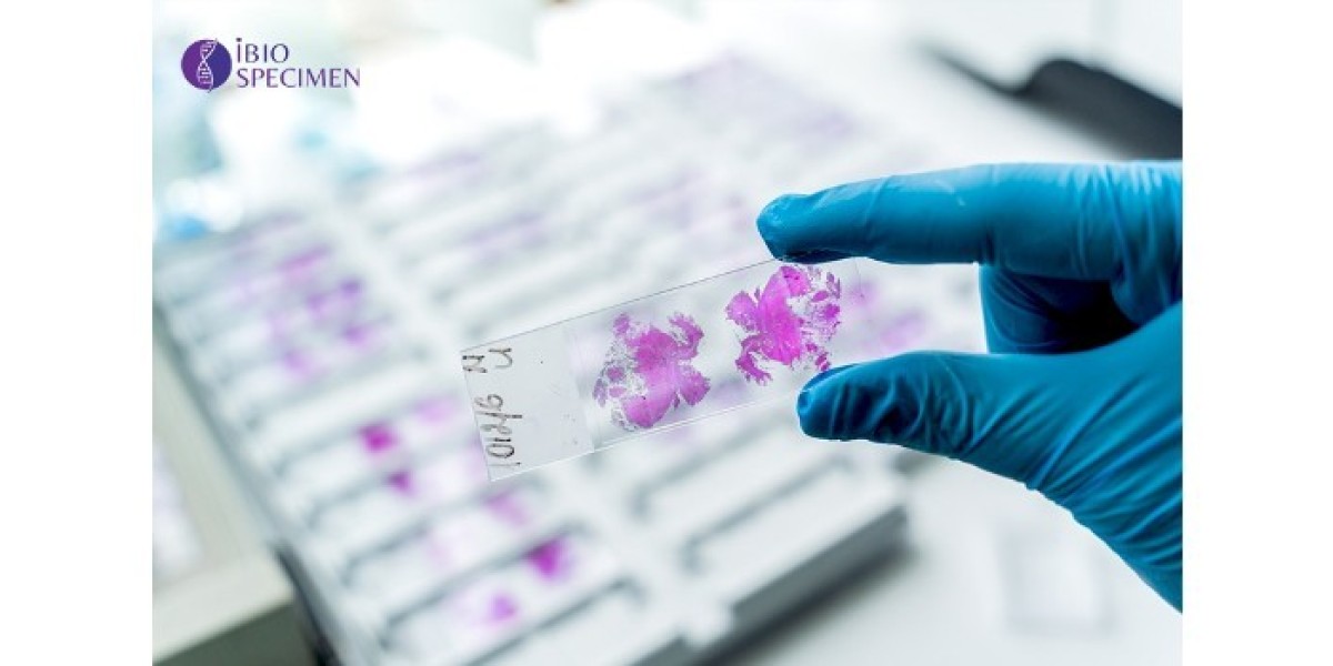 The Future of Research: Human FFPE Tissue Samples in the USA