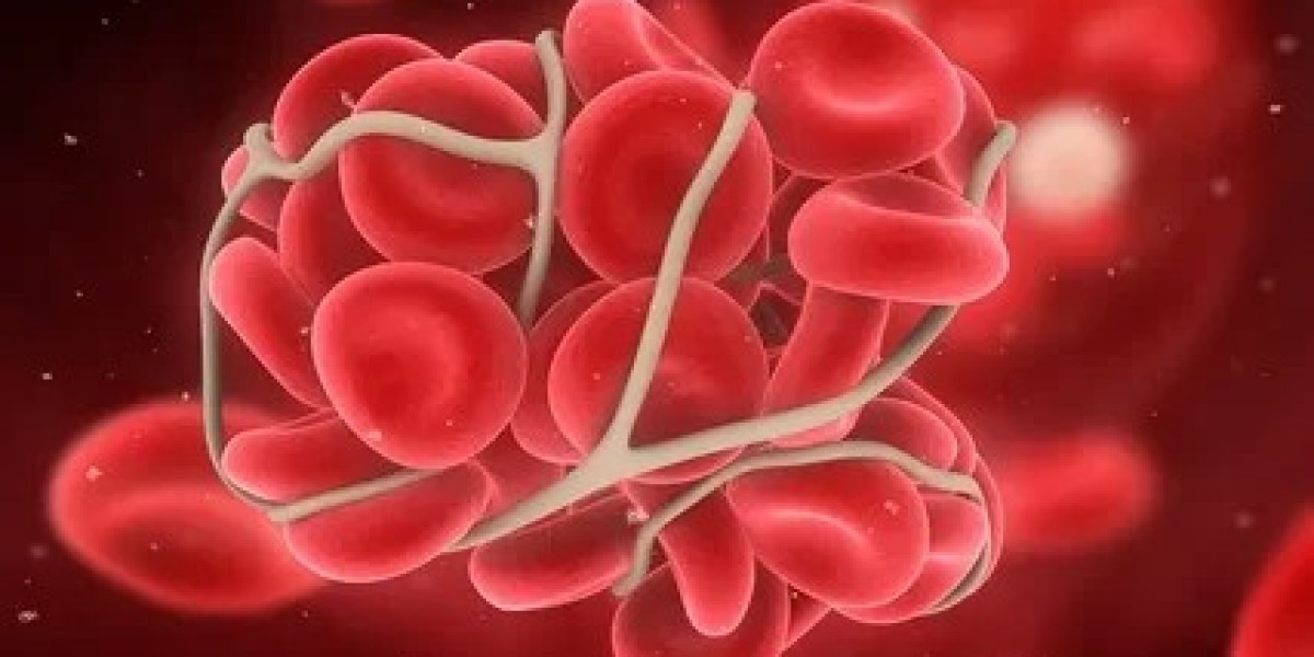 Article Picture