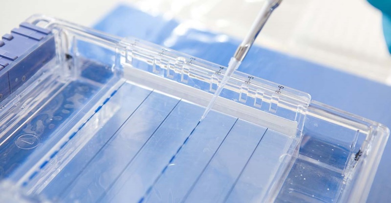 22 Examples of Gel Electrophoresis in Real Life - BiologyEye