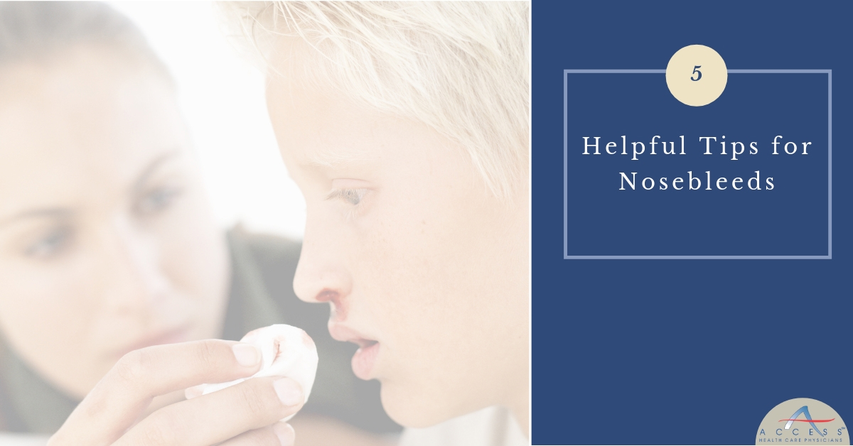 Nosebleeds: 5 Essential Tips for Prevention and Management | TechPlanet