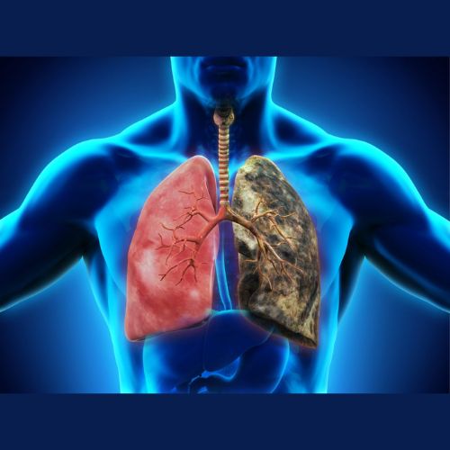 How Family History Can Affect Your Risk of Developing Lung Cancer? – TeamCnut