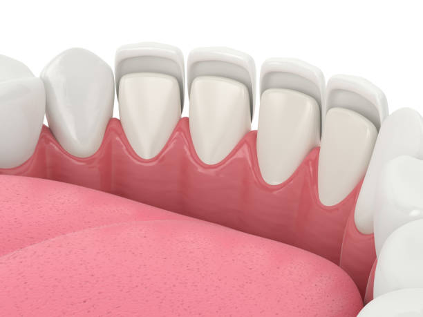 “The Role of Dental Crowns in Children’s Cosmetic Dentistry” – Telegraph