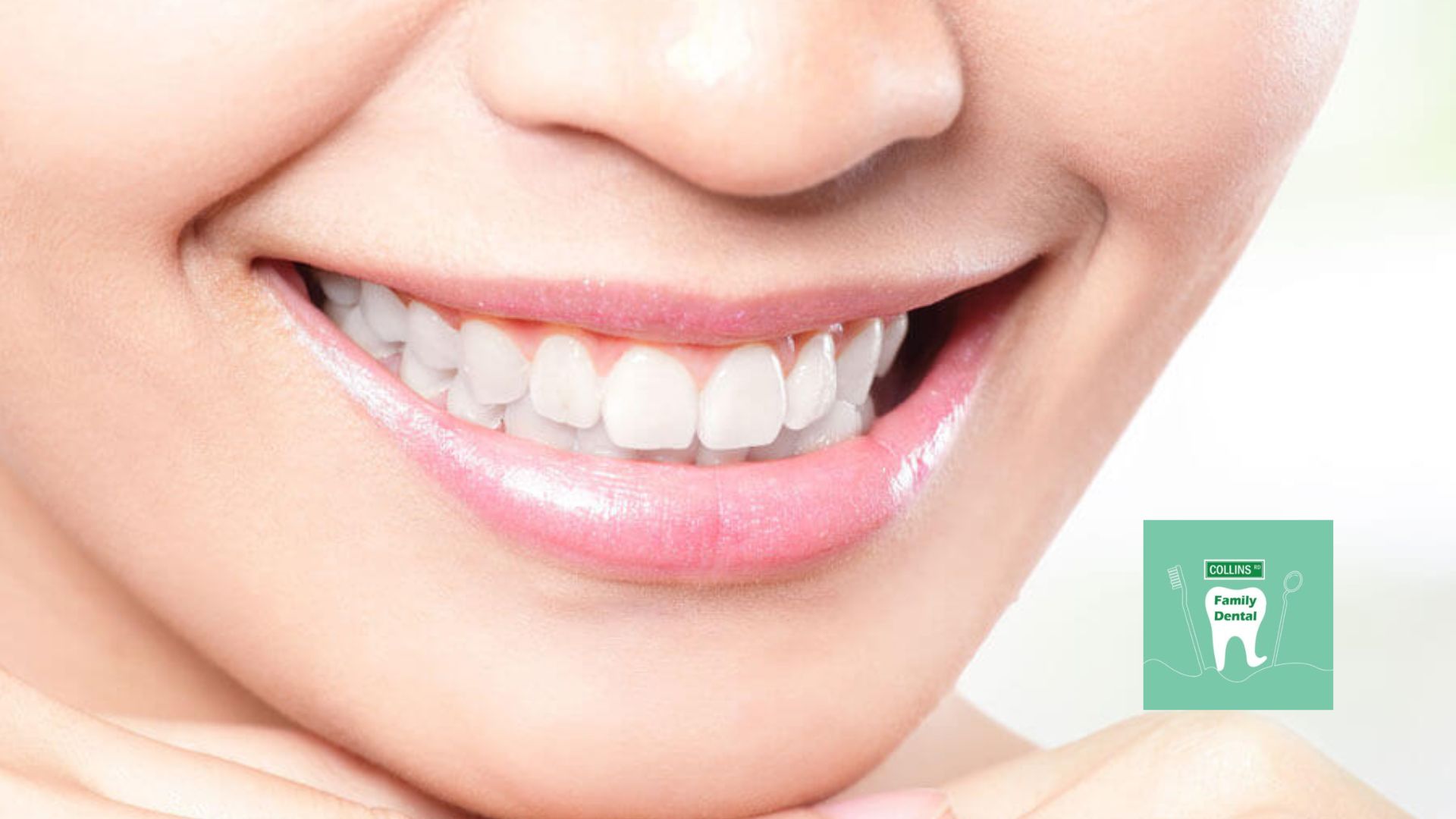Teeth Whitening Bristol CT | Collins Road Family Dental – Collins Road Family Dental
