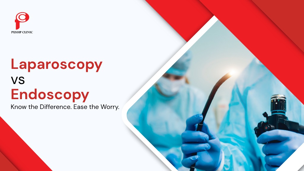 Laparoscopy vs Endoscopy – What’s the Difference?