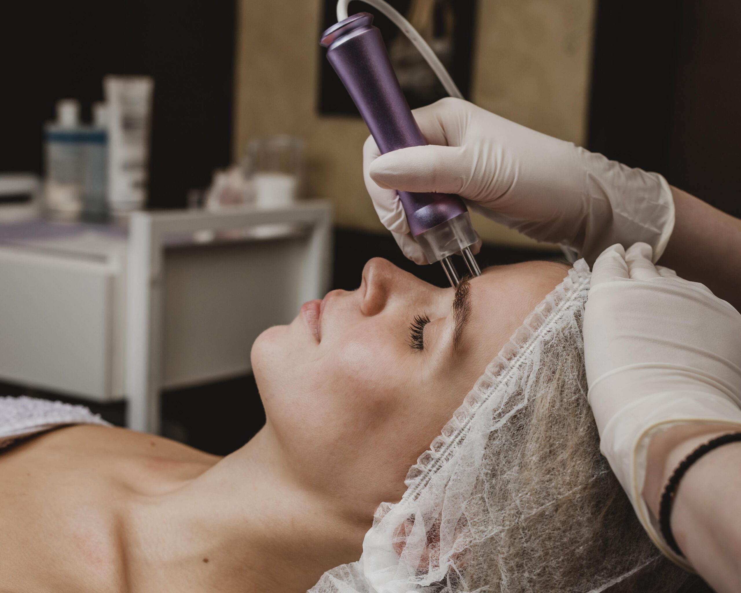 SQT Microneedling Safe for Sensitive Skin? Medusa Beauty Zone